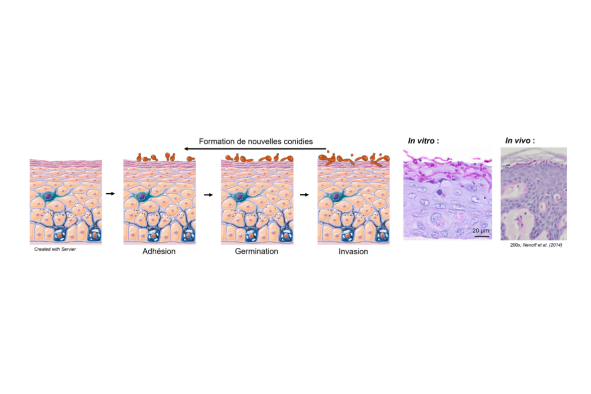 Représentation schématique des différentes étapes de l’infection cutanée par dermatophytes